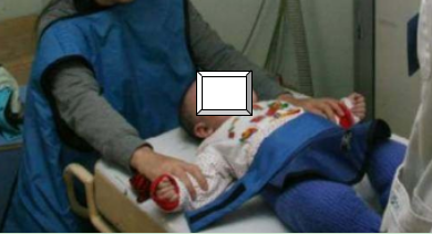 1567764512114219.png 放射.png