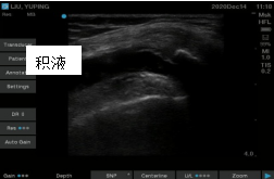 肌骨.png