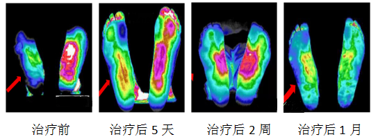 红外3.png
