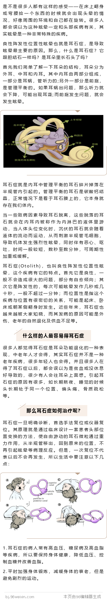 耳石症.png